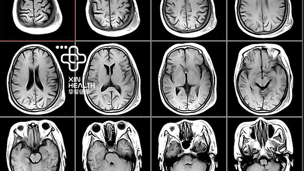 先进又安全的核磁共振 MRI